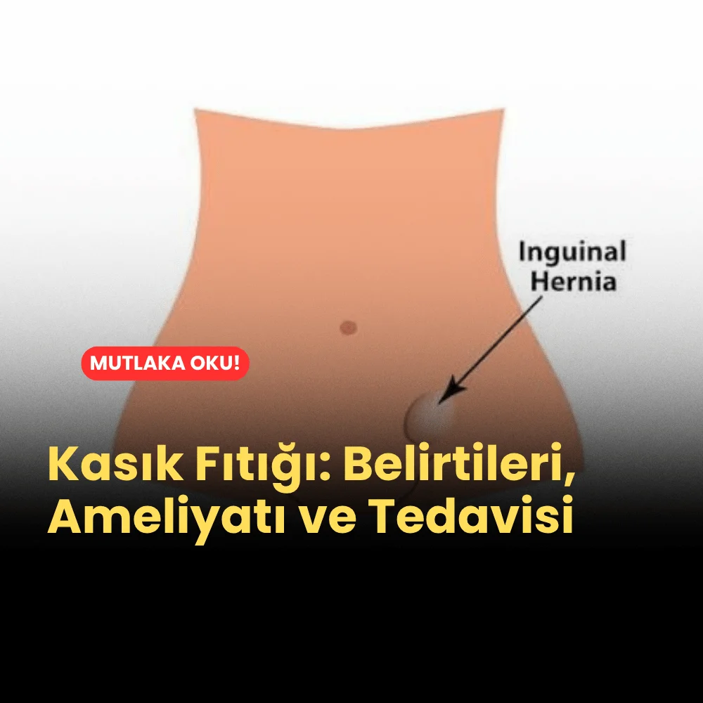 Kasık Fıtığı Belirtileri, Ameliyatı ve Tedavisi