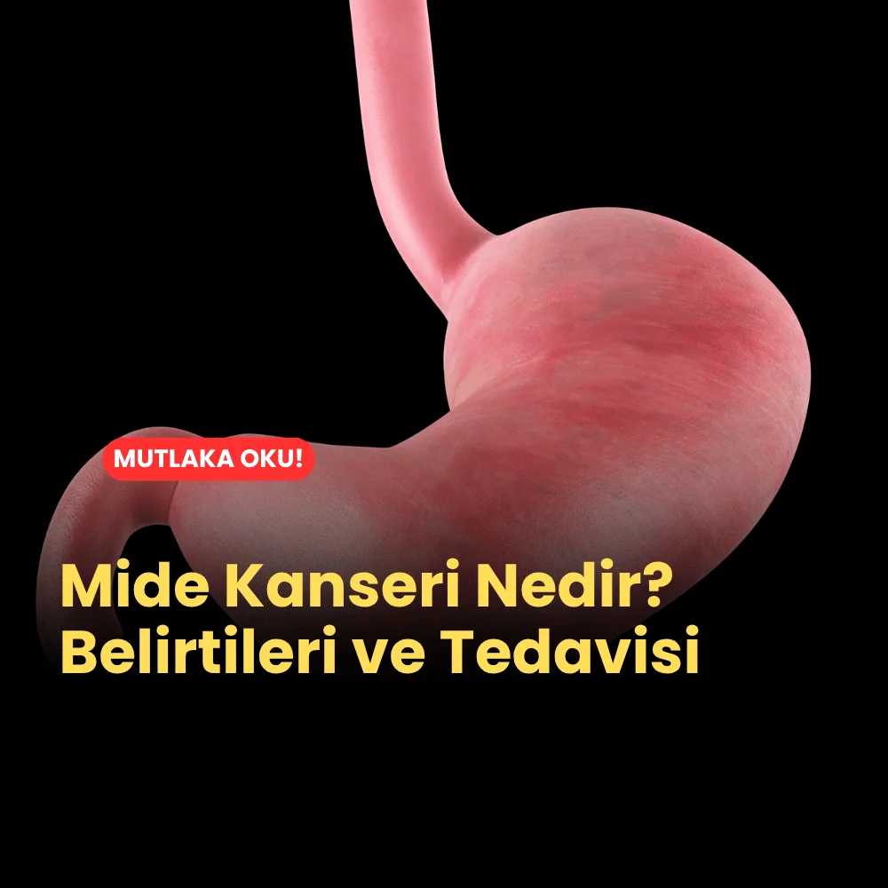 Mide Kanseri Nedir? Belirtileri ve Tedavisi Ne