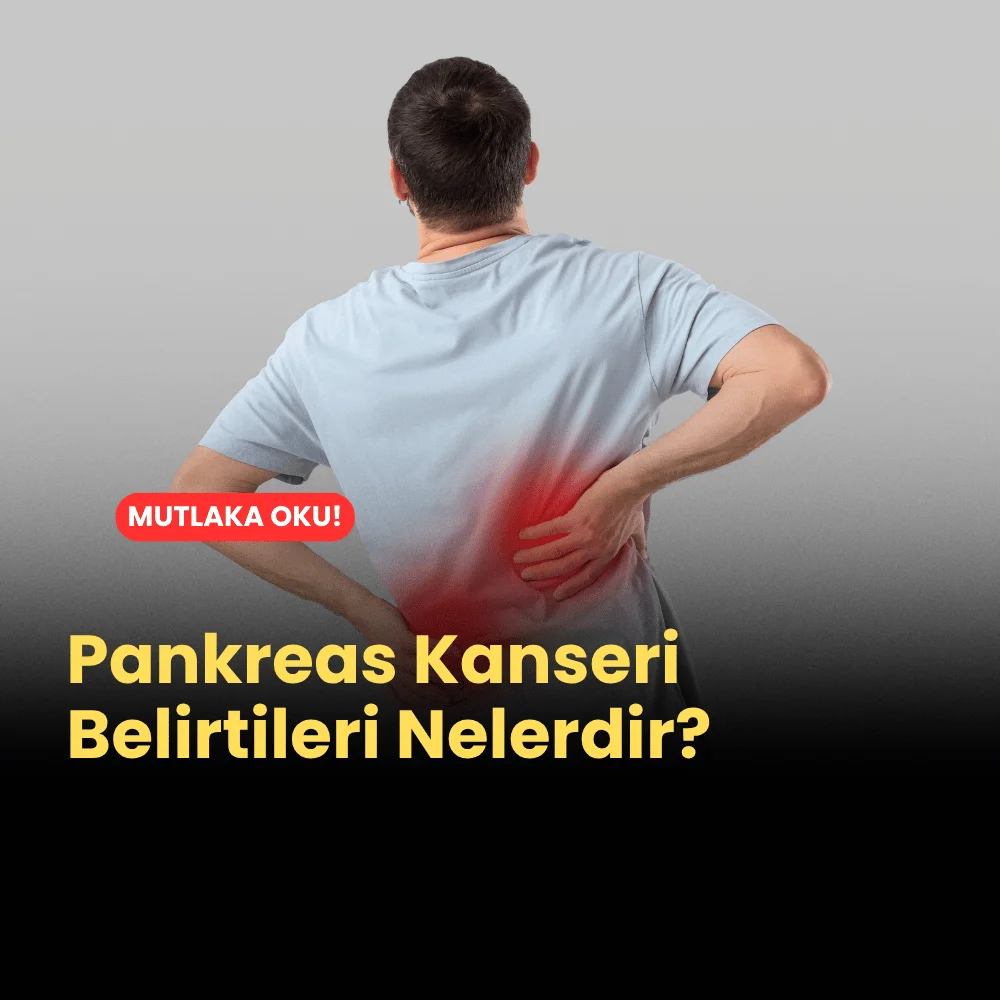 Pankreas Kanseri Belirtileri Nelerdir