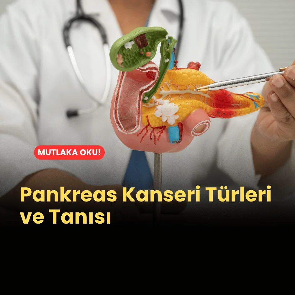 Pankreas Kanseri Türleri ve Tanısı