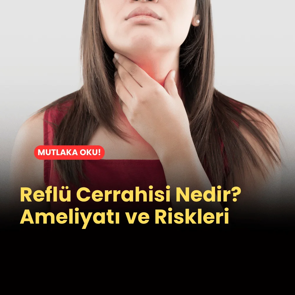Reflü Cerrahisi Nedir? Ameliyatı ve Riskleri Nedir